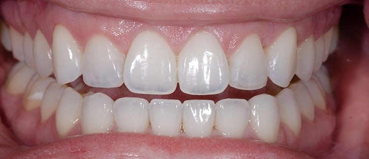 smile gallery photo