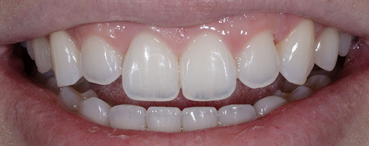 smile gallery photo